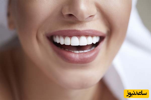 رفع فاصله بین دندان‌ها بدون ارتودنسی امکان پذیر است؟