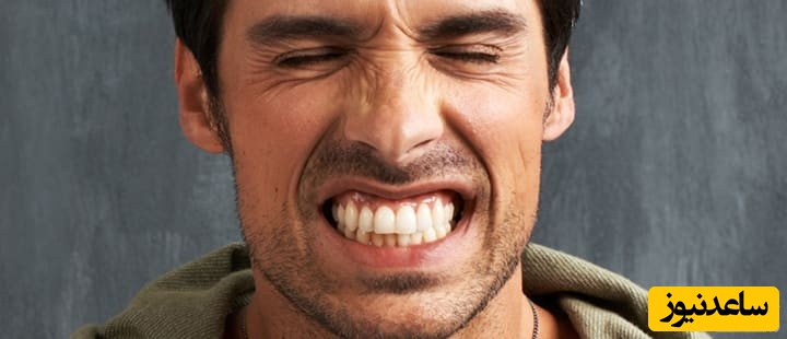 علل و درمان براکسیسم یا دندان قروچه