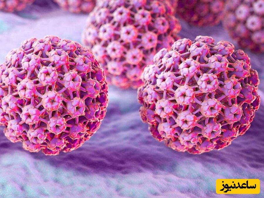 شرایط فریز کردن زگیل تناسلی در زنان و مردان