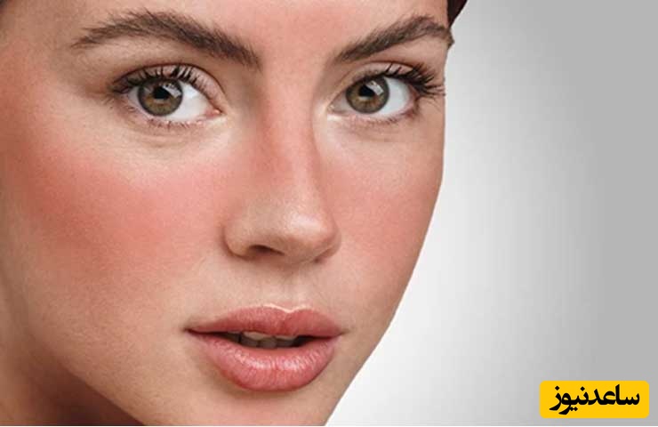 چند ماسک طبیعی که برای درمان آفتاب سوختگی معجزه می‌کند