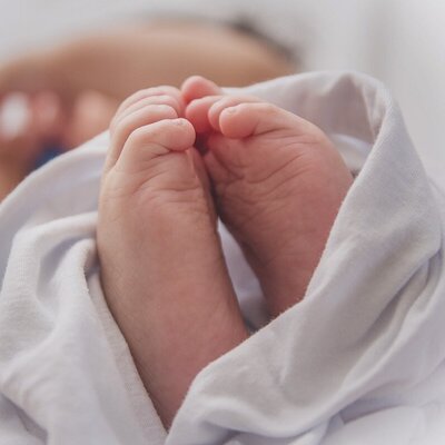 تولد عجیب یک نوزاد با دو سر+عکس