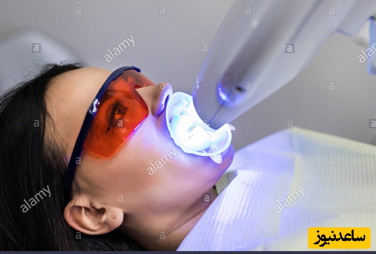 چرا باید از روش بلیچینگ دندان استفاده کرد ؟