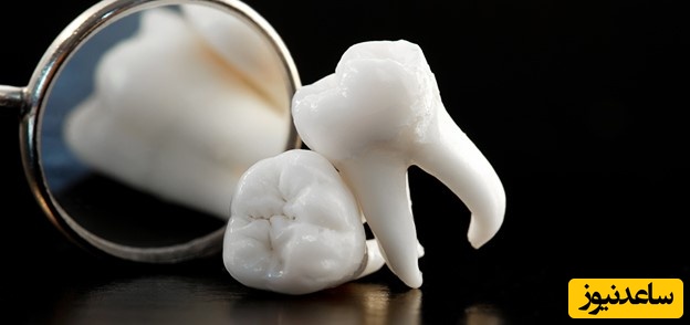 سوالات متداول در مورد درمان ریشه دندان