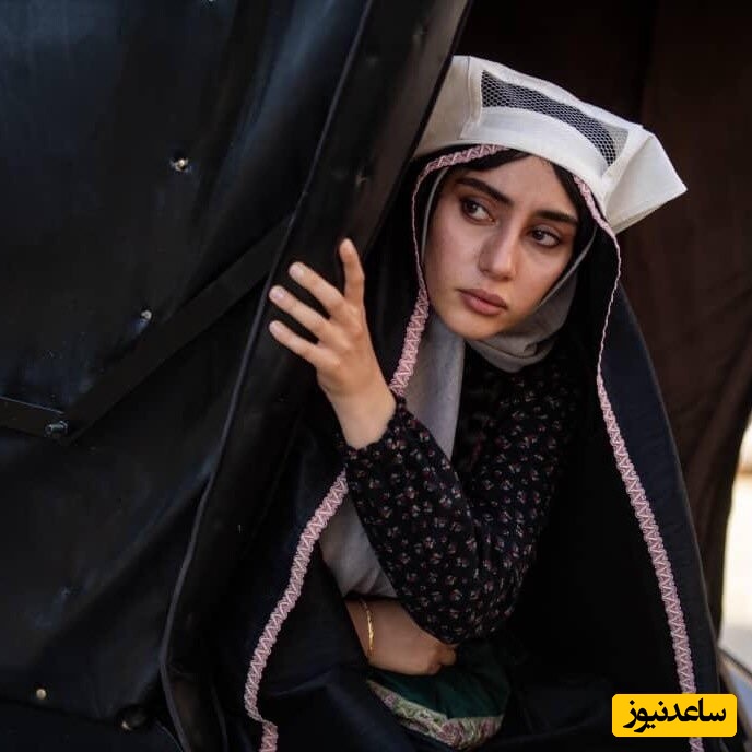 ترلان پروانه تغییر چهره داد ؛ خانم بازیگر همان آدم سابق نیست