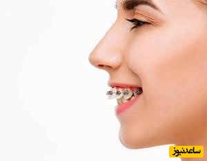 روش درمان دیپ بایت چگونه است؟