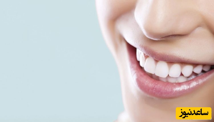 همه‌چیز در مورد عوارض اصلاح طرح لبخند