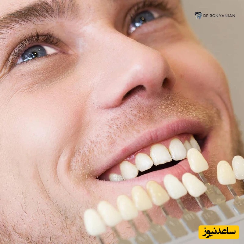 بهداشت دهان و دندان و نقش آن در زیبایی