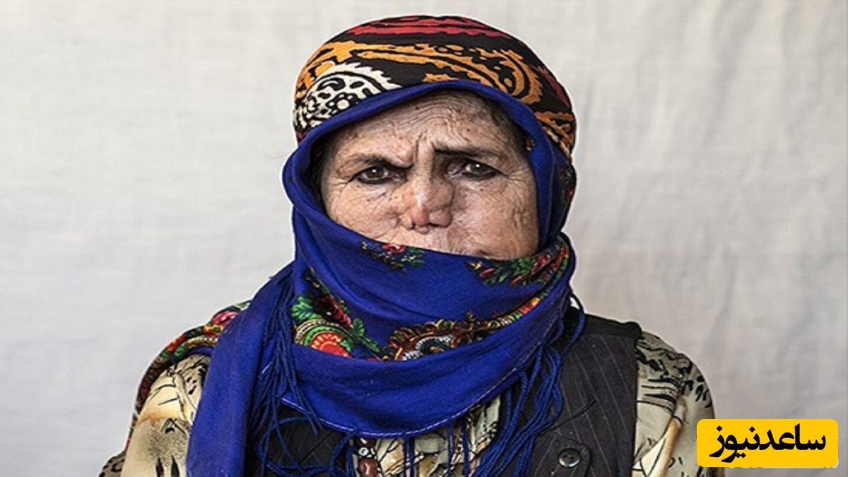 دیدن جذام در خواب چه تعبیری دارد؟ / تعبیر خواب جذام