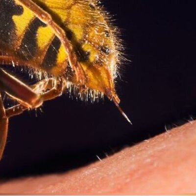 (ویدئو) نمای نزدیک از نحوه عملکرد نیش زنبور عسل روی پوست انسان