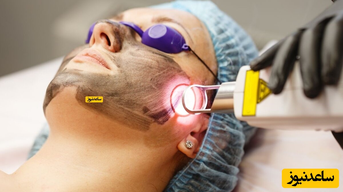 بررسی روش های درمان منافذ باز پوست توسط دکتر مسعود جعفری