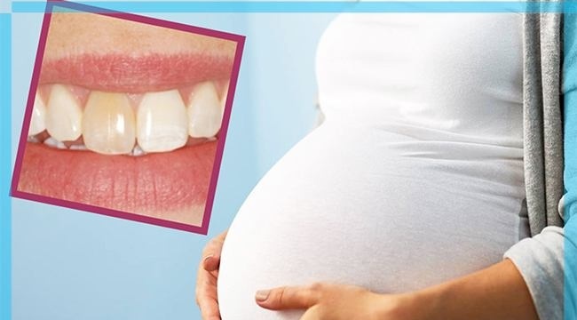 نکات بهداشت دهان و دندان در دوران بارداری