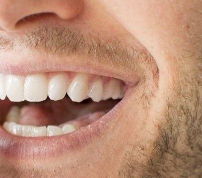 چرا دچار کیست دندانی میشویم؟