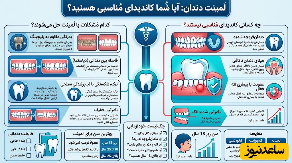لمینت دندان برای چه کسانی مناسب است؟