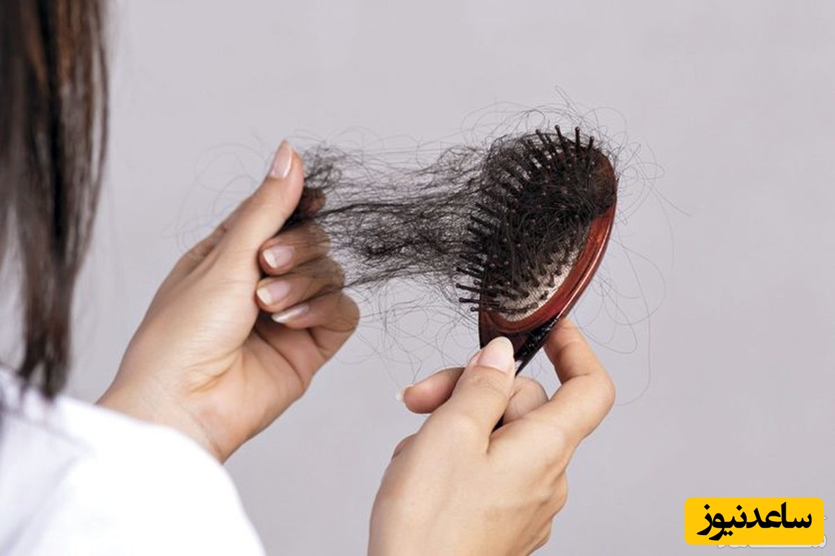 چگونه ریزش طبیعی مو را با از دست دادن مو تشخیص دهیم؟