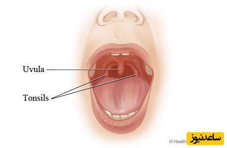 تورم زبان کوچک و علل آن