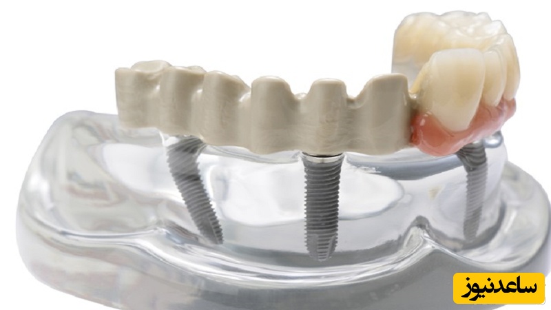 انواع اوردنچر و مزایای درمانی ان