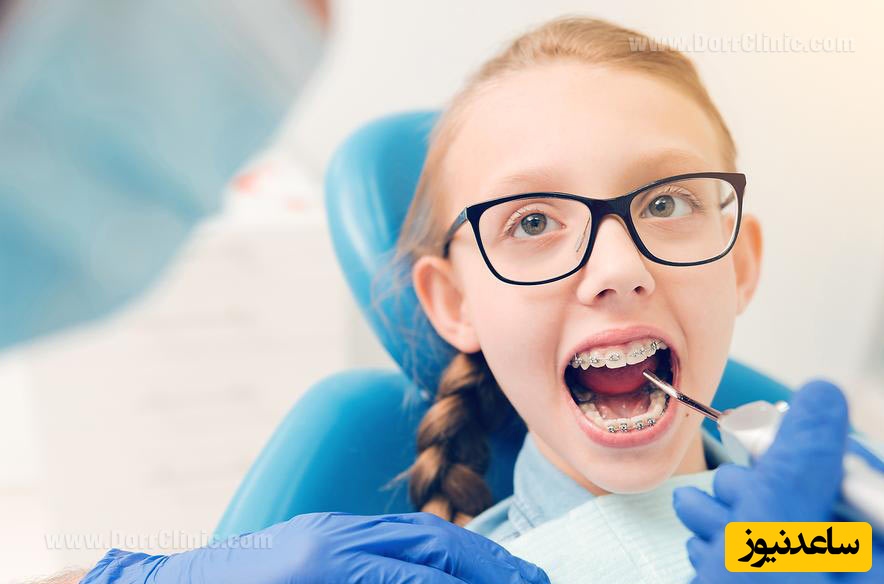 نامرتبی دندان ها + نکات مهم