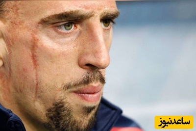 نگاهی به زندگی مشقت بار یک کارگر ساختمانی با صورت زخمی؛ ستاره‌ای که با فوتبال زندگی‌اش را ساخت/ وقتی خدا بخواد اینجوری برات میچینه!