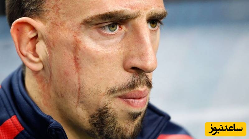 نگاهی به زندگی مشقت بار یک کارگر ساختمانی با صورت زخمی؛ ستاره‌ای که با فوتبال زندگی‌اش را ساخت/ وقتی خدا بخواد اینجوری برات میچینه!