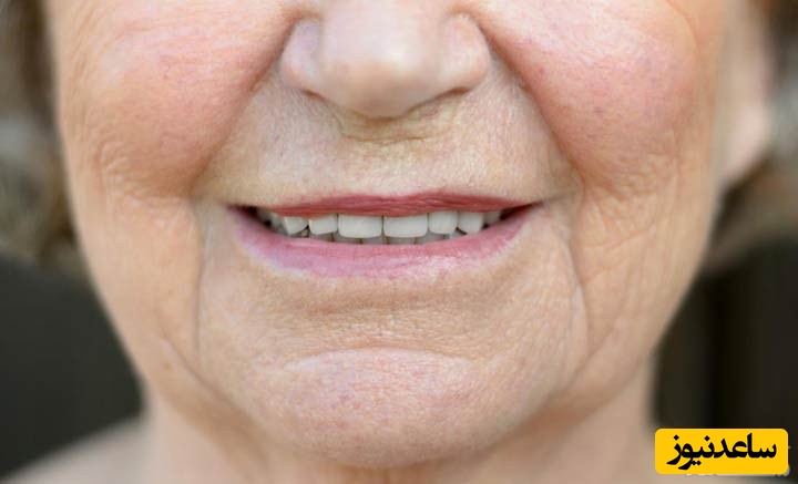 جلوگیری از پیر شدن لبخند