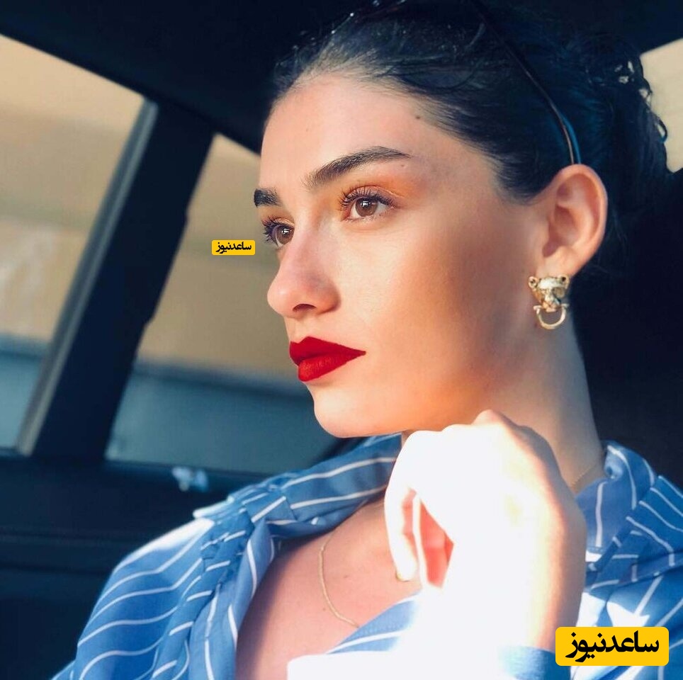 چرا هازار ارگوچلو این بلا را سر عکسش آورده؟!