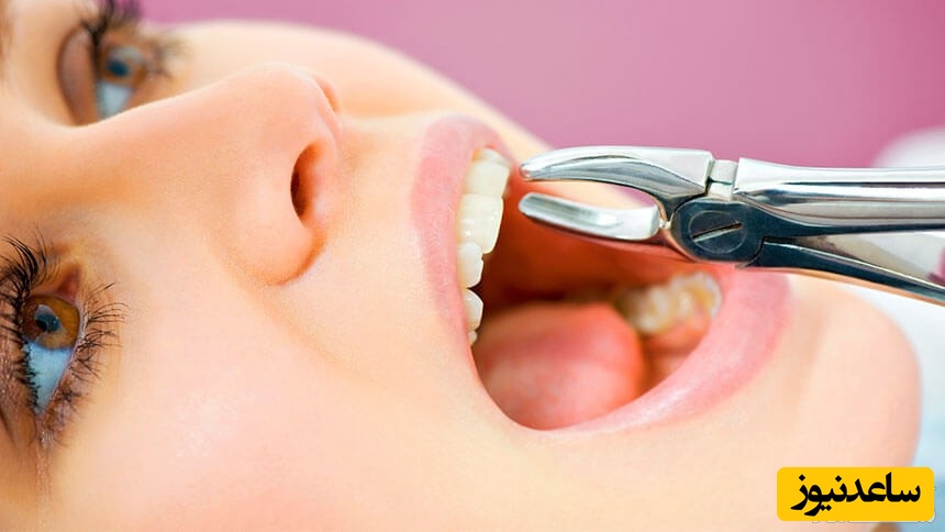 برای جلوگیری از خونریزی دندان کشیده شده چکار کنیم؟