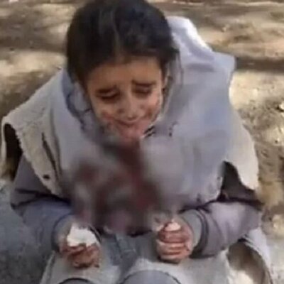 پشت پرده ماجرای صورت خونینِ دختر محصل به خاطر حجاب