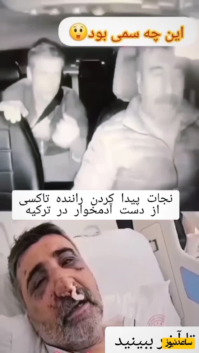 لحظه وحشتناک راننده تاکسی که مسافر آدمخوار به پستش خورد؛ بیچاره صورتش را با دندان از جا کند / از فیلم ترسناک هم ترسناک‌تره🔞