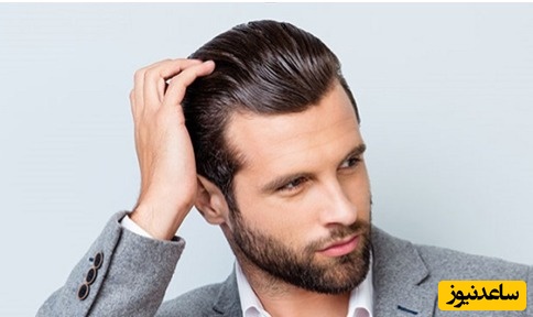 بهترین روش کاشت مو در مردان + 5 روش برتر کاشت مو آقایان
