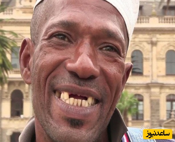 کشیدن دندان‌های جلویی در آفریقا! یک آیین، مد و یا طغیان برده‌ها؟