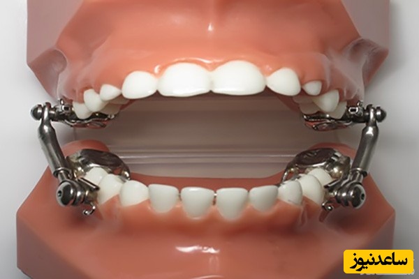 وسایل مخصوص ارتودنسی کدامند؟