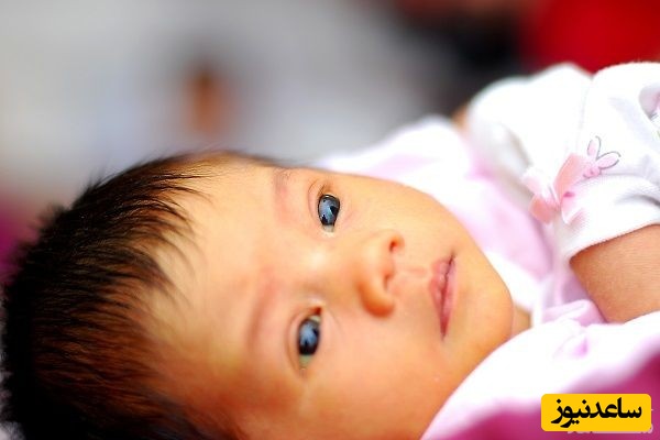 ایجاد زردی چشم در نوزادان و کودکان