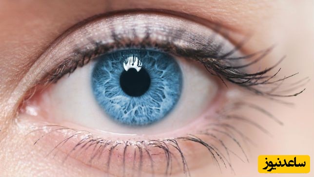 تغییر رنگ چشم با تزریق آمپول در ایران!