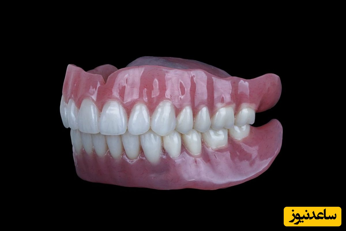 پروتز کامل دندان و سوالات رایج در مورد آن