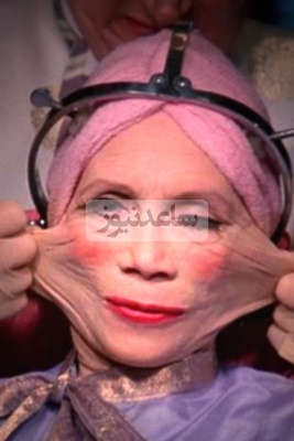 بازدید میلیونی فیلم ادعای زن ایرانی با 388 بار عمل زیبایی که در گینس ثبت شد / دکترا گفتند سه روز بیشتر زنده نمیمونم