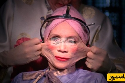 بازدید میلیونی فیلم ادعای زن ایرانی با 388 بار عمل زیبایی که در گینس ثبت شد / دکترا گفتند سه روز بیشتر زنده نمیمونم