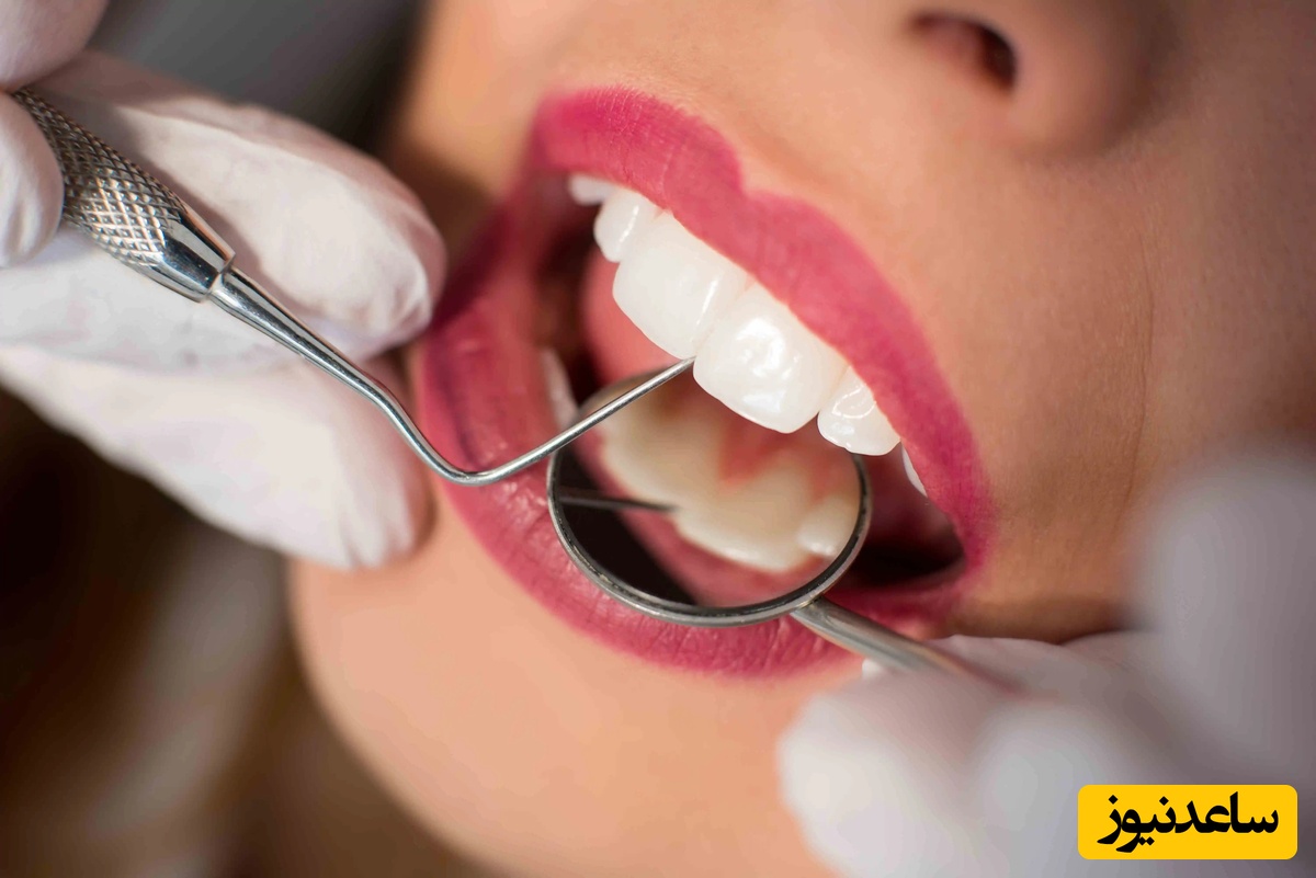 اصلاح طرح لبخند با لیزر بدون ارتودنسی 