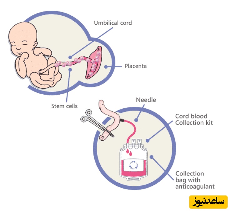 بند ناف جنین