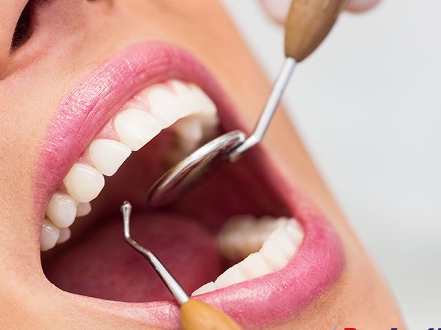 3 روش ساده برای از بین بردن پلاک دندان