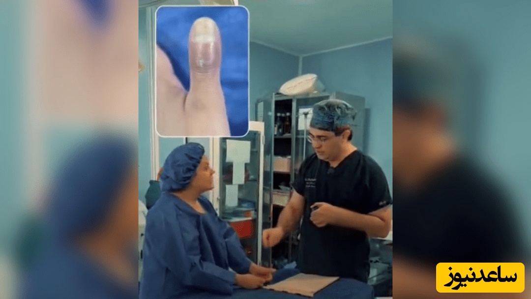 خانم ایرانی: رفتم ناخن کاشتم، حالا باید انگشتم رو قطع کنن! + عکس / این روزها همه ناخن کار شده‌اند، شما چطور؟!