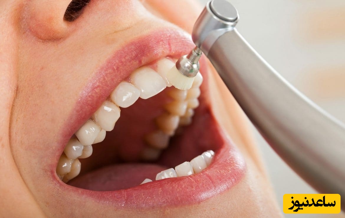 عوامل خطر پوسیدگی دندان در بزرگسالان چیست؟