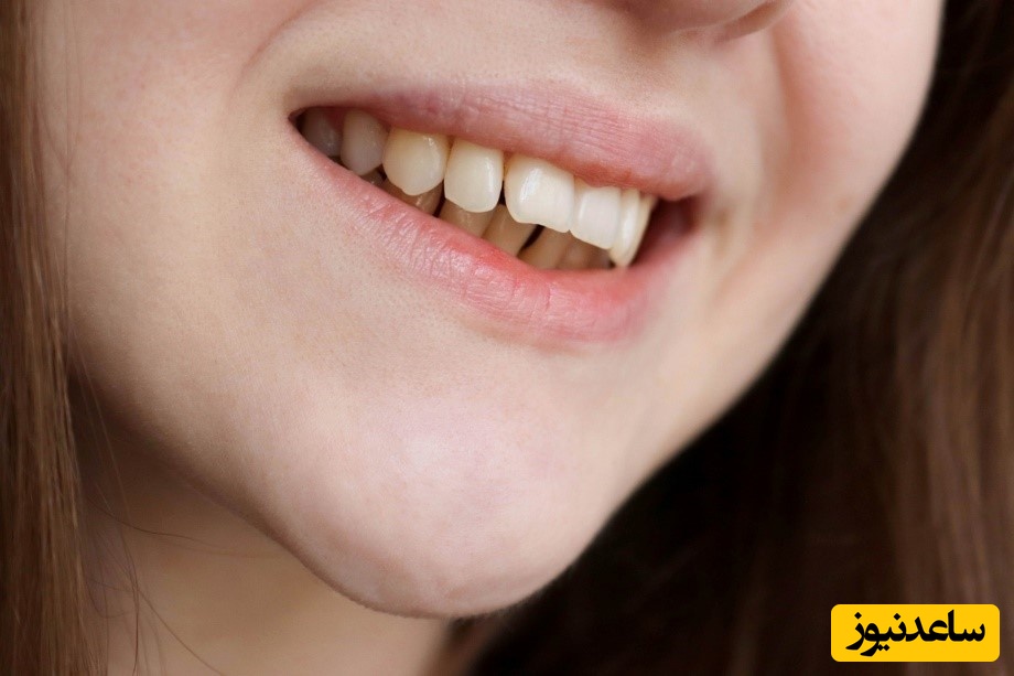 مراقبت های لازم پس از انجام جراحی فک و هزینه ی آن