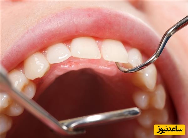حقایق مرتبط با مراقبت از دندان و لثه