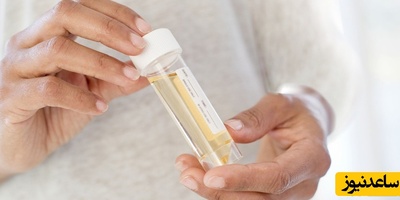 هشدار بارداری! دفع پروتئین در ادرار را نادیده نگیرید!