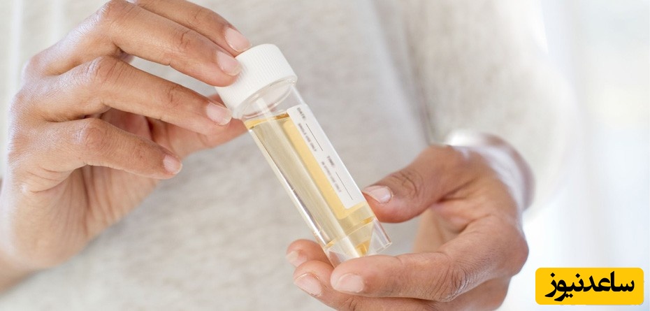 هشدار بارداری! دفع پروتئین در ادرار را نادیده نگیرید!