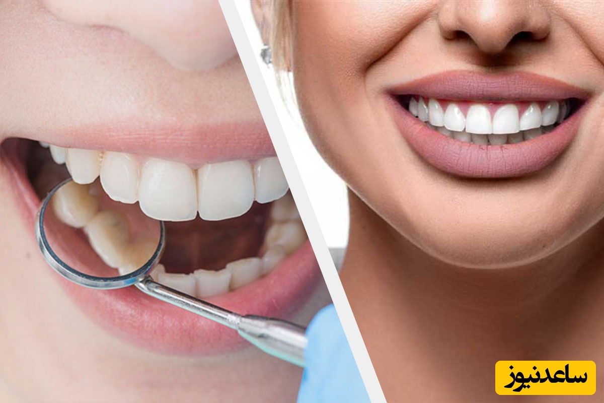 تکنیک‌های رایج برای خارج کردن ایمپلنت ناموفق چیست؟