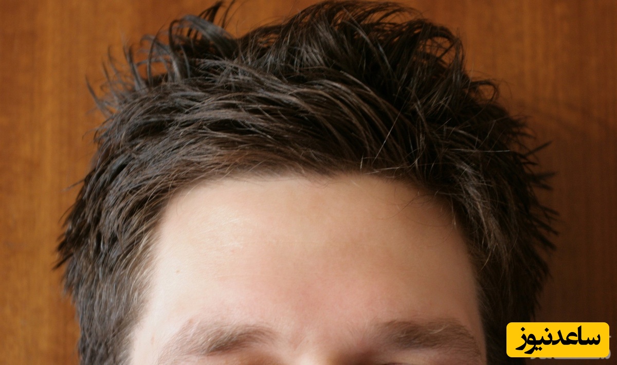 دیدن پیشانی بلند و صاف در خواب چه تعبیری دارد؟ / تعبیر خواب پیشانی