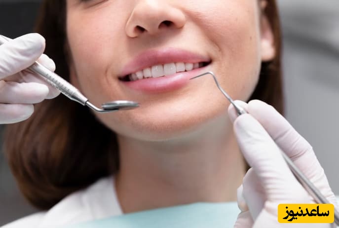 بهترین زمان انجام فیشورسیلانت