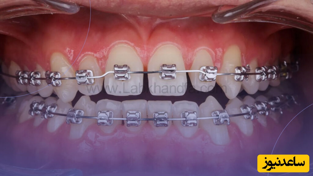 تفاوت بین دندانپزشک و متخصص ارتودنسی