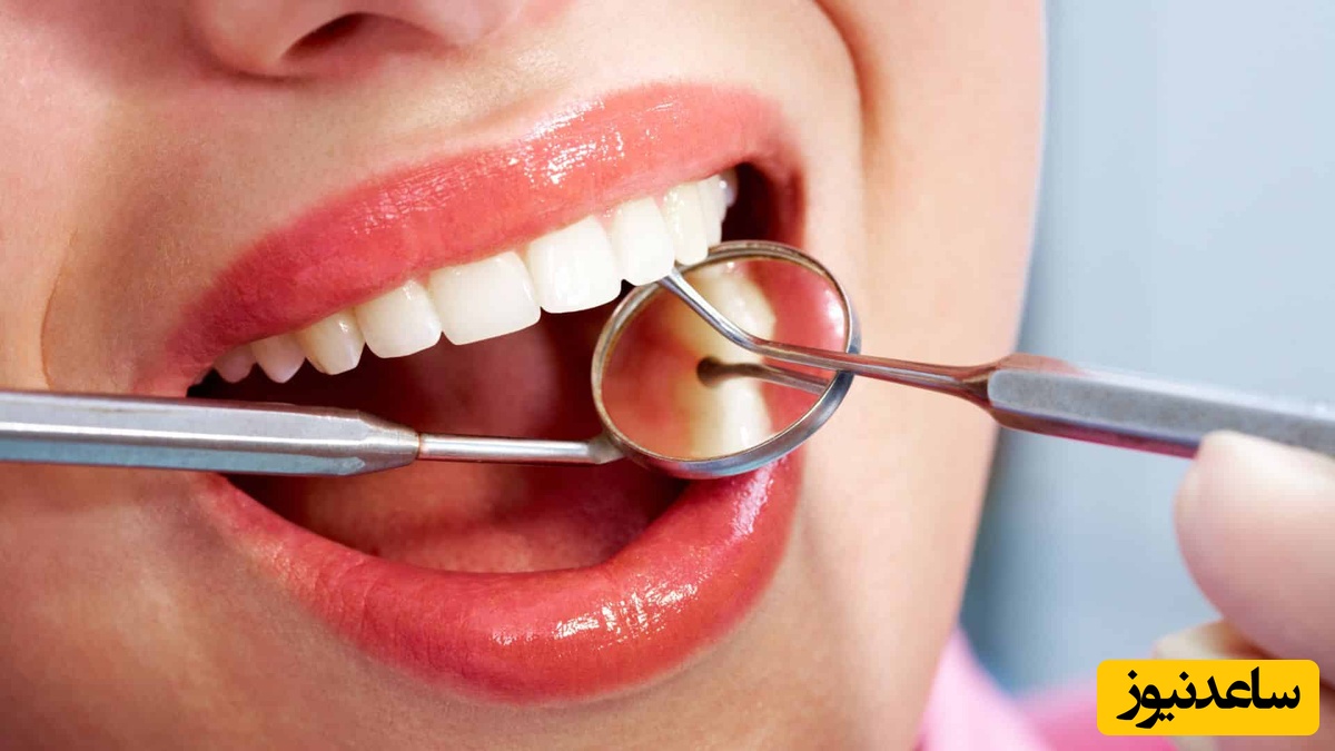 روش های طبیعی اصلاح طرح لبخند چیست؟